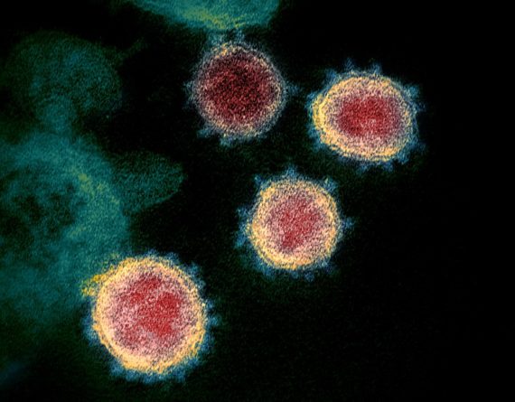 Coronavirus : André Bonnet plaide aujourd’hui devant le Conseil d’Etat pour l’autorisation d’utiliser la chloroquine chez les porteurs du COVID-19 Coronavirus Conseil Etat autorisation chloroquine COVID 19 André Bonnet